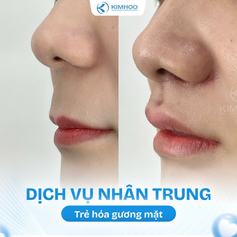 Kết quả 7 – Nhân Trung