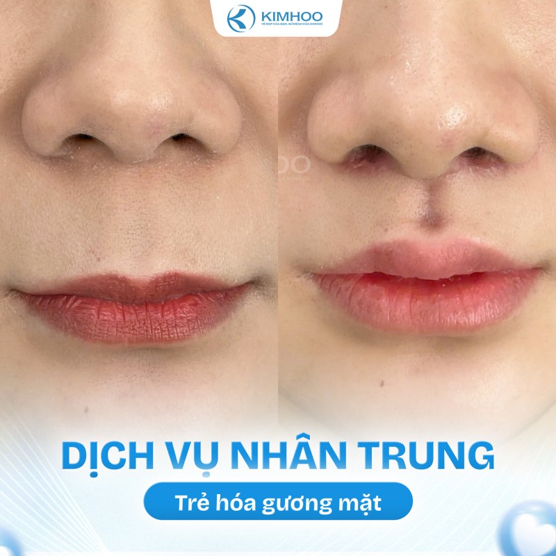 Kết quả 9 – Nhân Trung