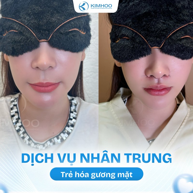 Kết quả 10 – Nhân Trung
