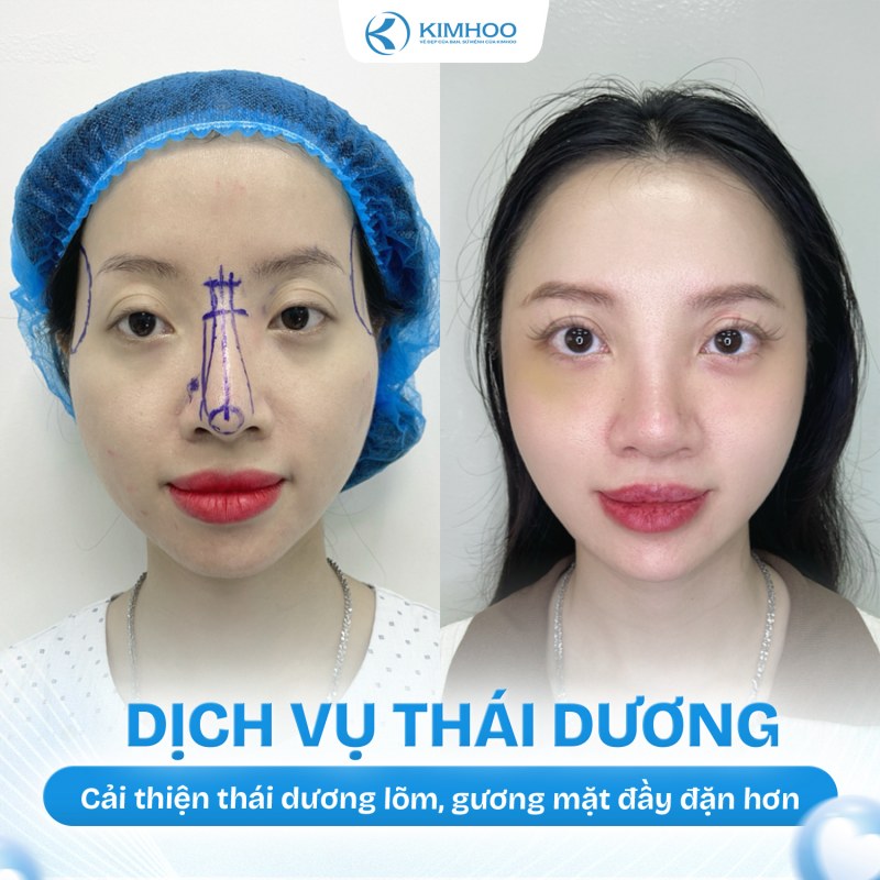 Kết quả 8 – Độn Thái Dương